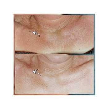 SkinGlow Patches - 2