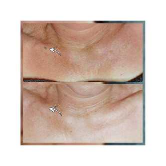 SkinGlow Patches - 2